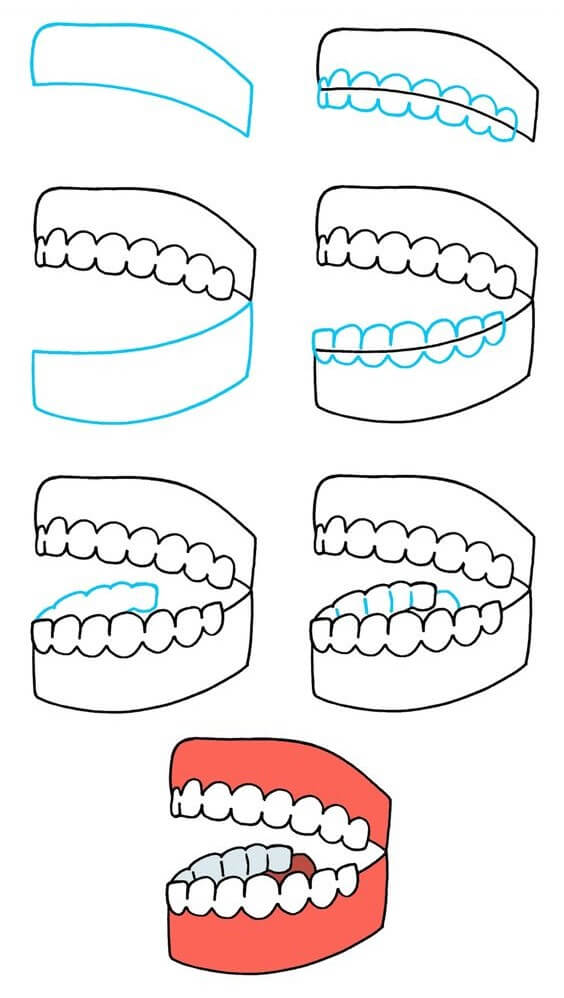 Idées sur les dents (1) dessin