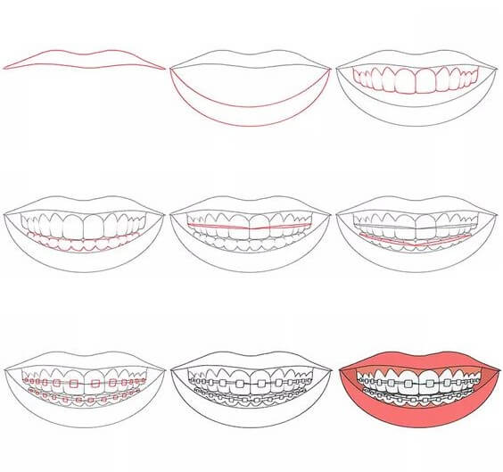 Idées sur les dents (4) dessin
